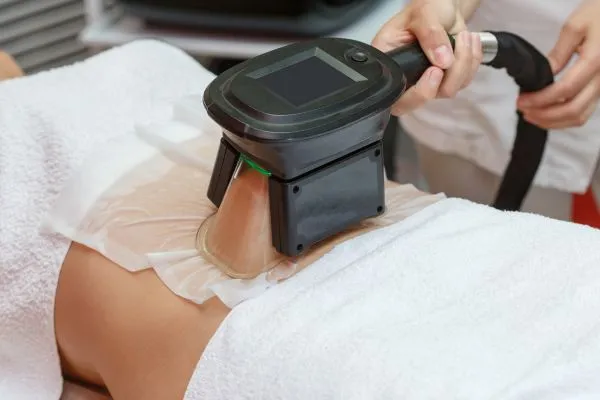 Image of person having fat freezing treatment to help weight gain Salisbury