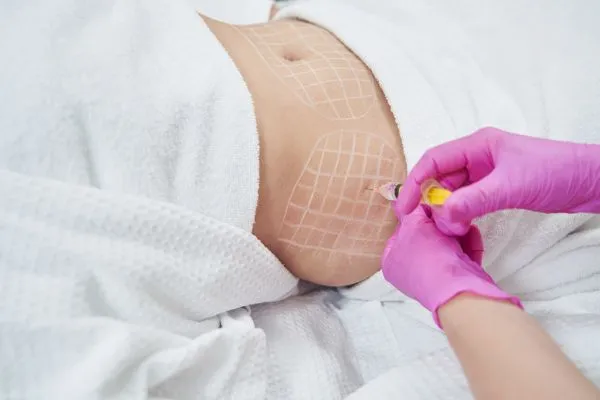 image of fat dissolving injections on love handles to help combat weight gain Salisbury