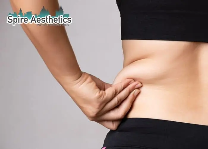 Image of woman pinching fat on their hips Salisbury. Fat Freezing treatment