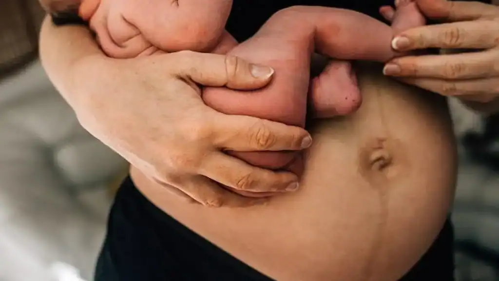 Why Is My Stomach Still Big After Pregnancy Salisbury?